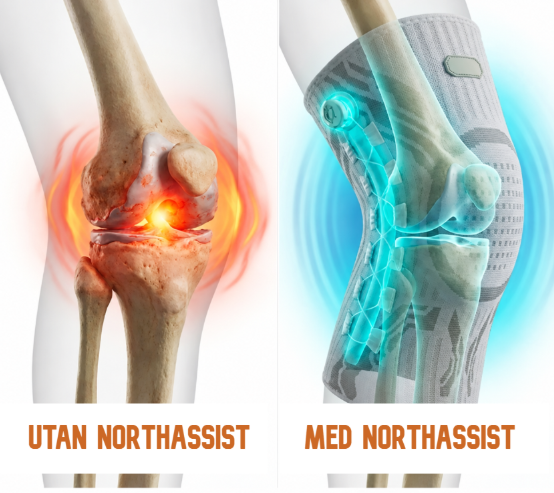 NorthAssist Knästöd